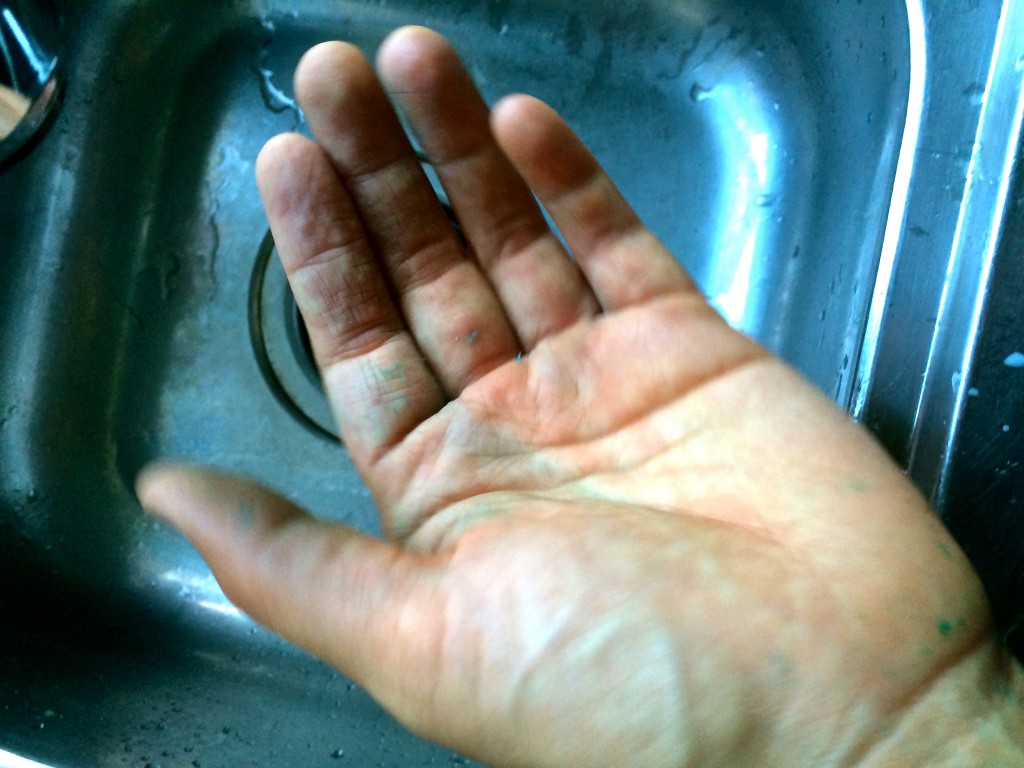 Still some pigment left over, but a big  difference.